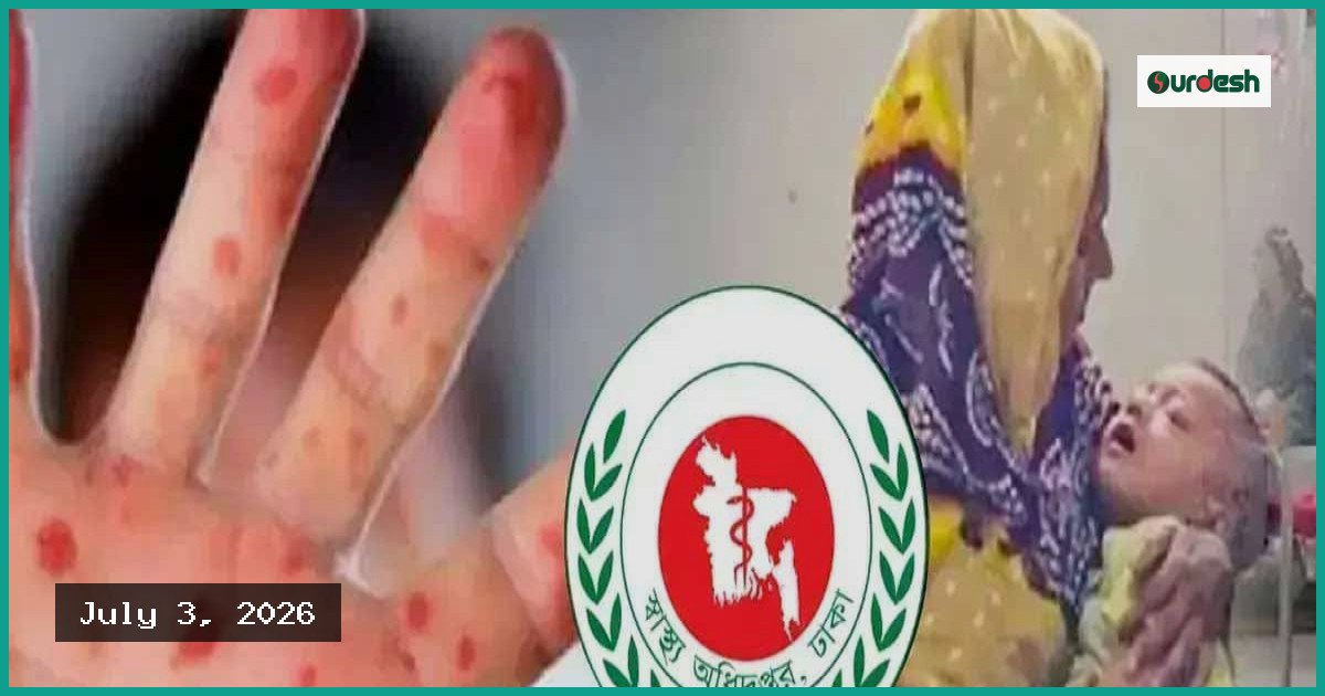 দেশে হাম ও উপসর্গে আরও ৫ শিশুর মৃত্যু