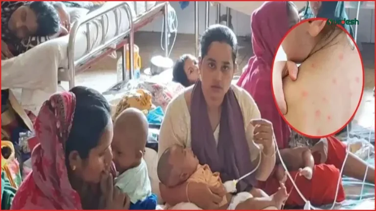হামের উপসর্গে আরও চার শিশুর মৃত্যু, আক্রান্তের সংখ্যা ১ লাখ ১৭ হাজার ছাড়াল