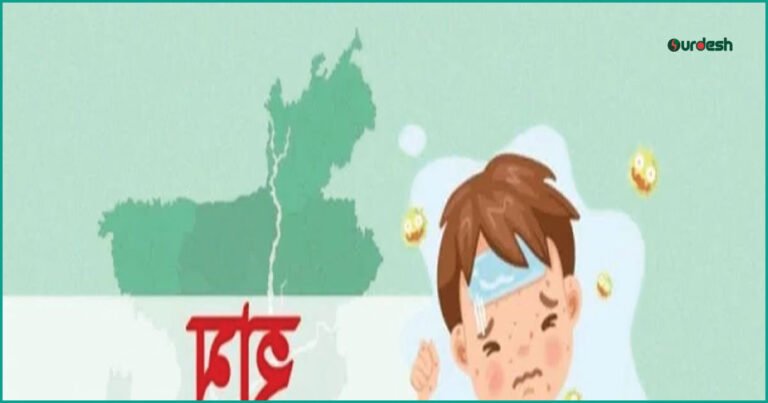 হামের প্রকোপ: ২৪ ঘণ্টায় আরও ৮ শিশুর মৃত্যু, আক্রান্ত ১,১৭১