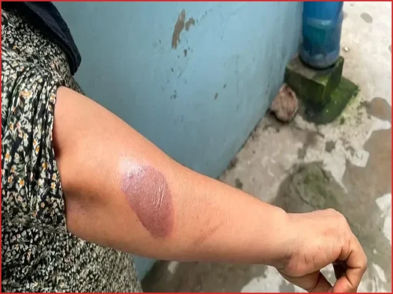 রাজধানীর কাজীপাড়া-শেওড়াপাড়ায় তীব্র গ্যাস সংকট: রান্নার ভোগান্তি